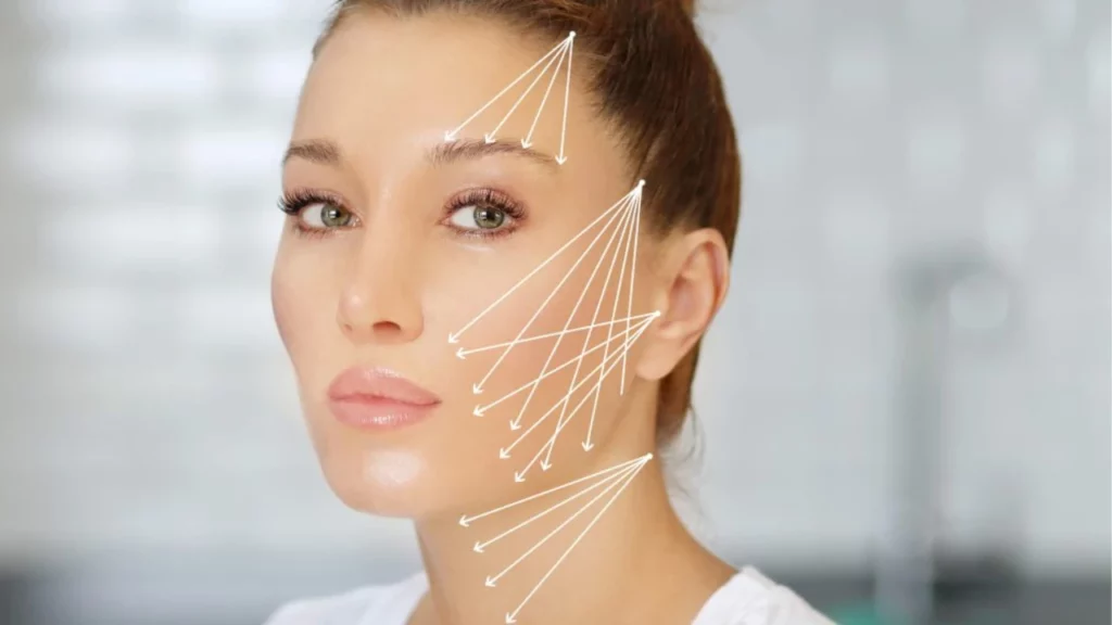 Thread lift treatment in Noida